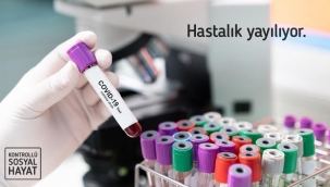 Kırıkkale Valiliği hastalık yayılıyor deyip kuralları açıkladı