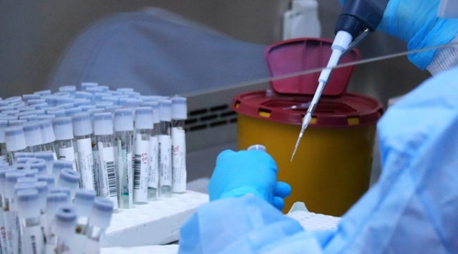 Günde 7 bin kişiye koronavirüs testi uygulanıyor
