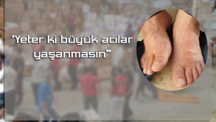 Alevler sönsün diye ayaklarında oluşan yaraların sızına dahi katlandı