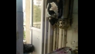 Erken müdahale ile facianın önüne geçildi